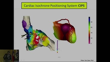 Caracterización de sustrato mediante análisis de EGMsy ”pace mapping” Dr. Shivkumar
