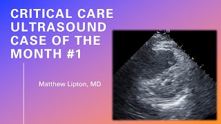 Case of the month #1 (no narration)