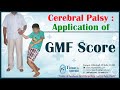 Cerebral Palsy : Application of GMF Score