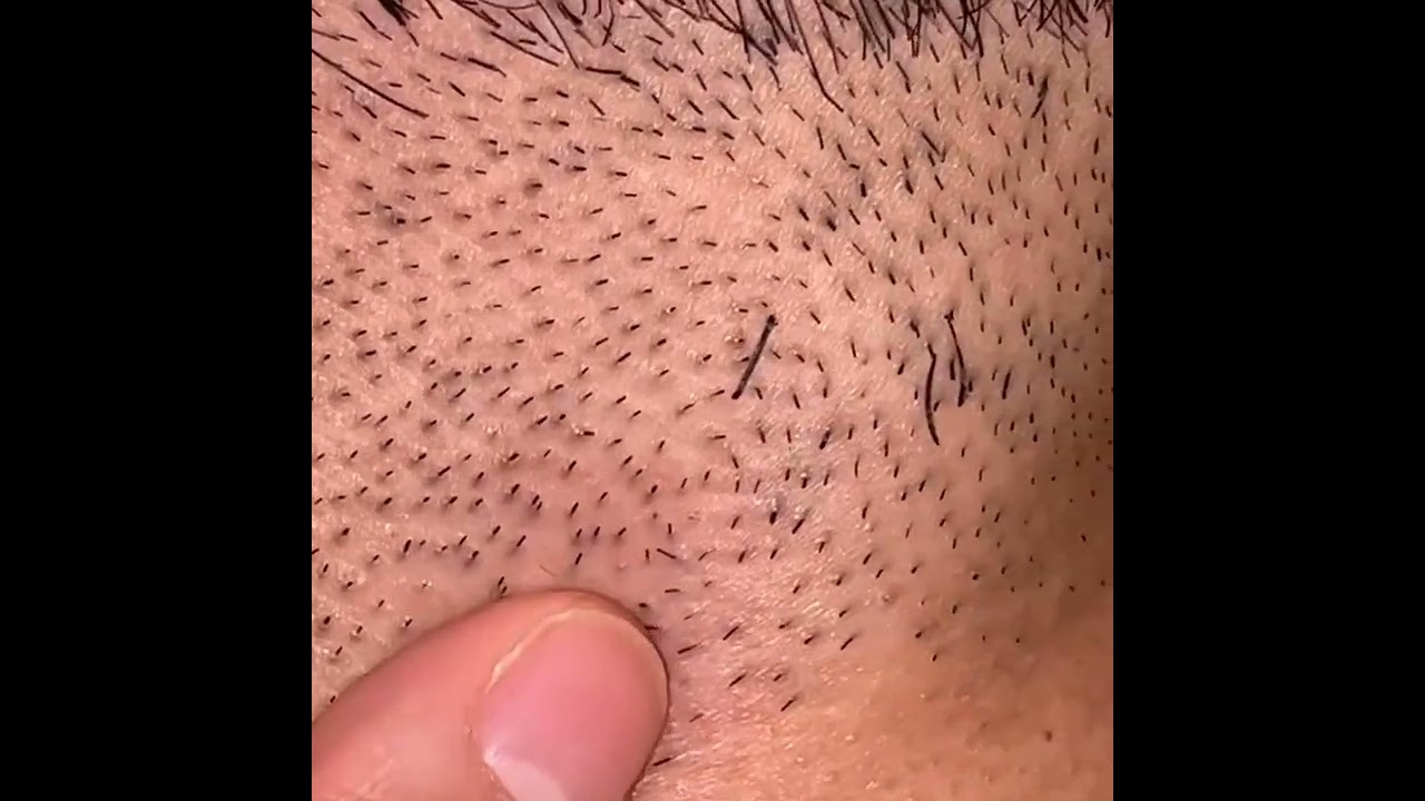 世にも奇妙な首ヒゲのツムジ Youtube