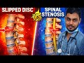 Herniated Disc vs Lumbar Spinal Stenosis difference .. Low back pain Explained Simply by Doctor ..