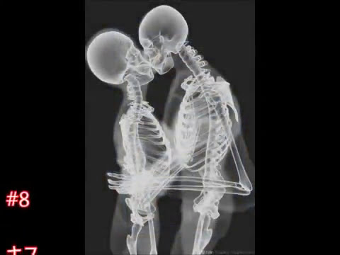 【衝撃】レントゲン画像で見る世界がヤバすぎる！②(一部閲覧注意あり)