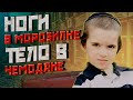 НОГИ В МОРОЗИЛКЕ, ТЕЛО В ЧЕМОДАНЕ//Дело раскрыто//Лейби Клецки