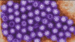 Norovirus, flu cases hit Georgia schools hard