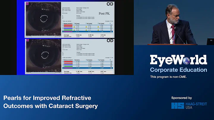 Pearls for improved refractive outcomes with Catar...