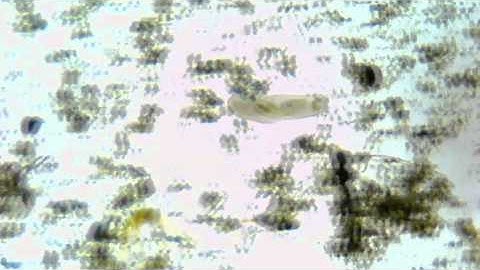 Free-Swimming Ciliate