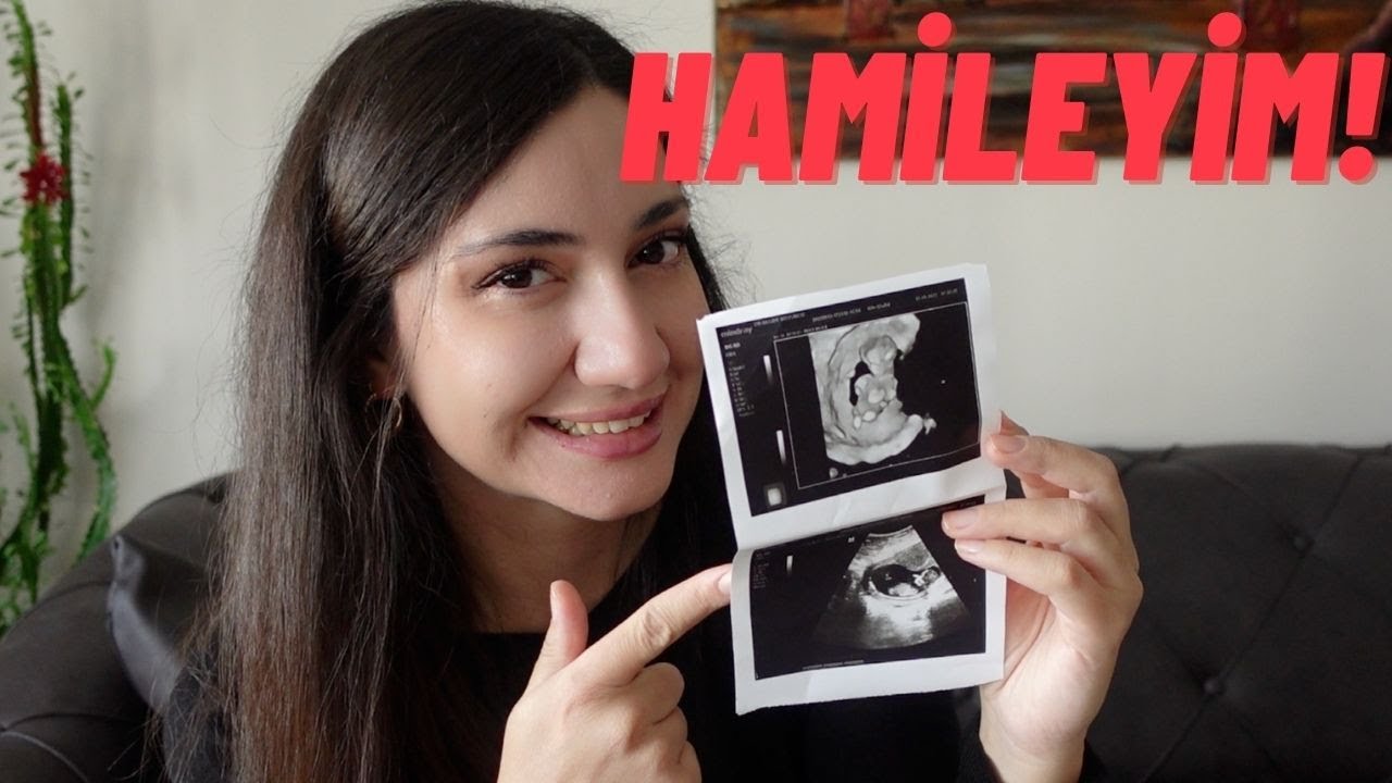 SÜPRİİİZ 🎉HAMİLEYİM 😍| Nasıl Anladım, İlk Üç Ay Nasıl Geçti, Bebeğin Cinsiyeti Her Şeyi Anlattım