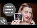 8 Week Bumpdate | Hello Morning Sickness | Pregnancy Journey [CC]