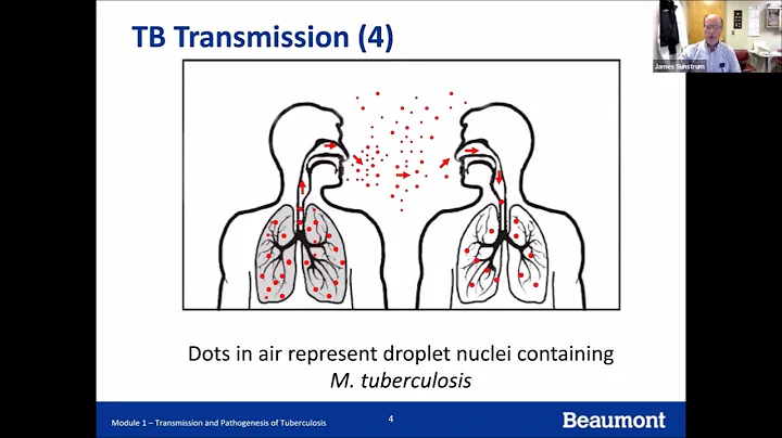 TB 101 Series 2023: Session 12 - TB Infection Control