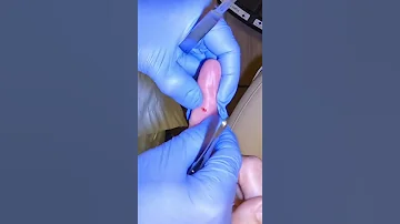 PULLING GLASS OUT OF A FINGER Shorts How 