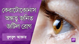 কেরাটোকোনাস, চোখের এক অন্ধত্ব জনিত জটিল রোগ | Keratoconus | Bulbul Akter | Goodie Life | 2025
