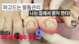 파고드는 발톱을 혼자서도 필 수 있다고??? 궁금한 사람들은 영상을 시청하세요! _미대살롱