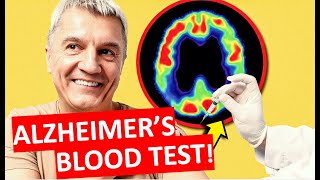Test for Alzheimer's Disease: New Quest Blood Test !
