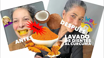 ¿La cúrcuma blanquea los dientes?