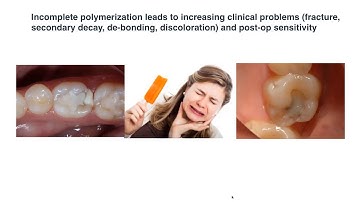 Dental Treatment: Mastering Light Curing Dec 11, 2019