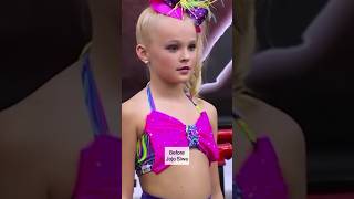 Before and Now 😍🔥 Jojo Siwa #shorts #jojosiwa #youtubeshorts #viral