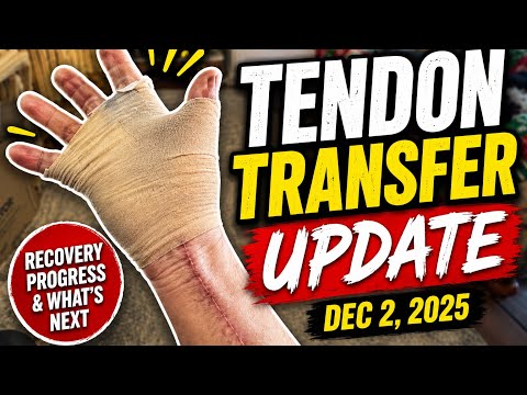 #Tendon #Transfer update December 2, 2025