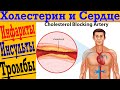 Холестерин и Сердце! Инфаркты, инсульты, тромбы и атеросклероз !