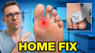 2nd Toe Capsulitis Taping | Dr. Tom's Best Home Treatment