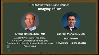 Imaging of HIV