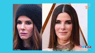 Sandra Bullock and Cheek Fillers?