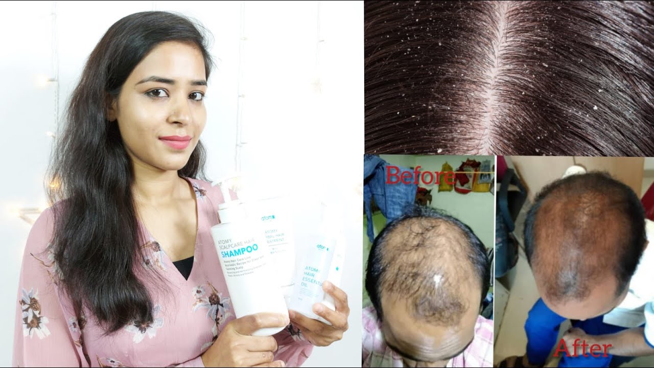 Atomy Hair Care Kit | Best Solution of all types Hair Problem|Hair fall|Dandruff|Dry hair
