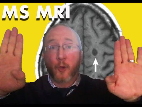 Answer Viewers Questions: