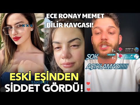 Ece Ronay Eski Eşi Mehmet BİLİR Tarafından Şi*det Gördüğünü Açıkladı  Kavga Görüntüleri Açıklaması!