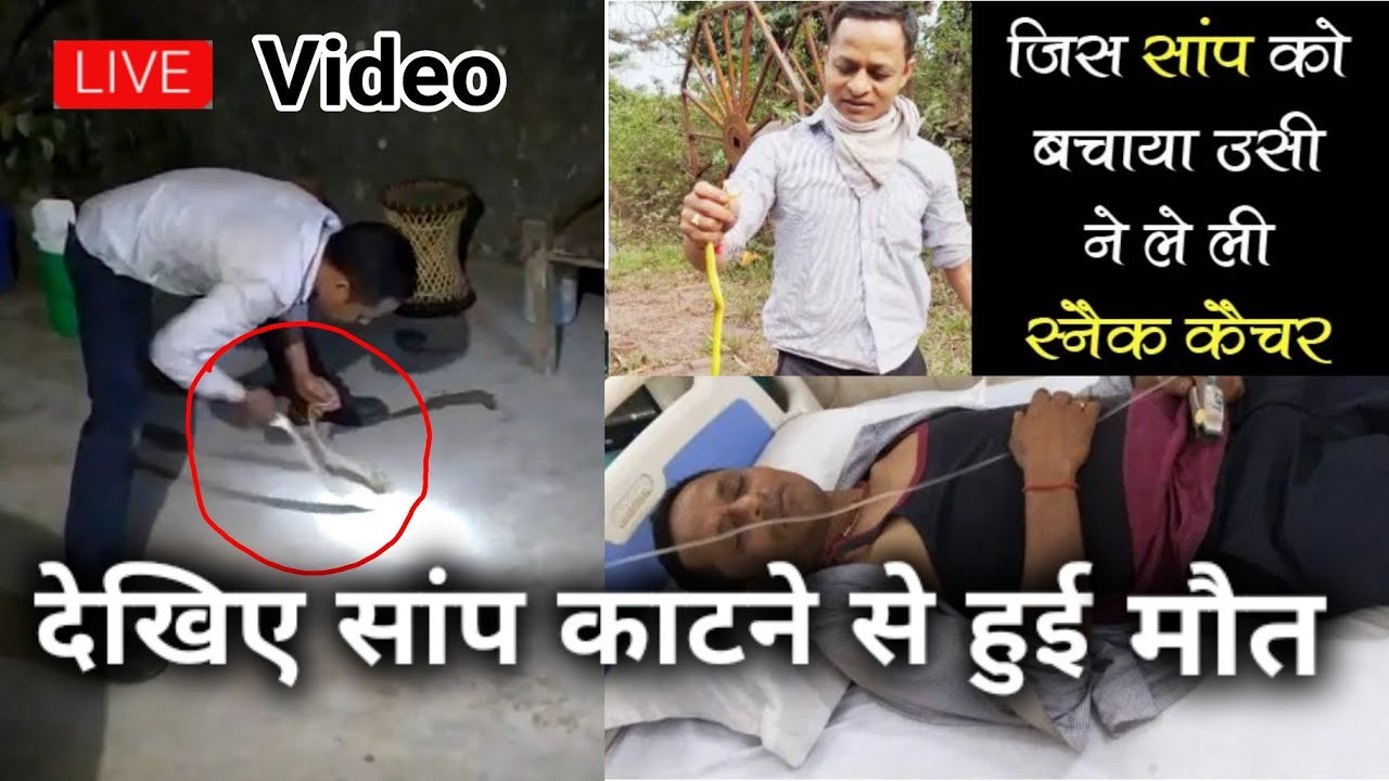 देखिए कैसे डस लिया इस सांप ने, Russell's Viper Snake Bites Prem Kumar Thakur