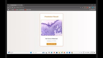 Comparative Analysis of Machine Learning Models for Oral Cancer Detection | AI Project