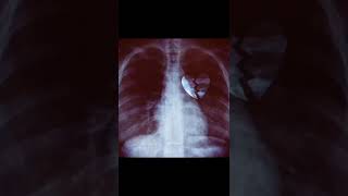 Yaralıyam - Anadolu Psychedelic Rock