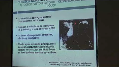 15. Cronificacin del dolor agudo. Dolor postoperatorio persistente