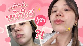 Skin care routine แชร์ไอเท็มเด็ดกู้หน้าใส ช่วงสิวบุก (Ver.ถูกและดี)║Evefee