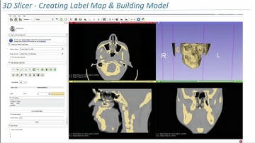 Segmentation techniques - 3D printing in Orthopedics