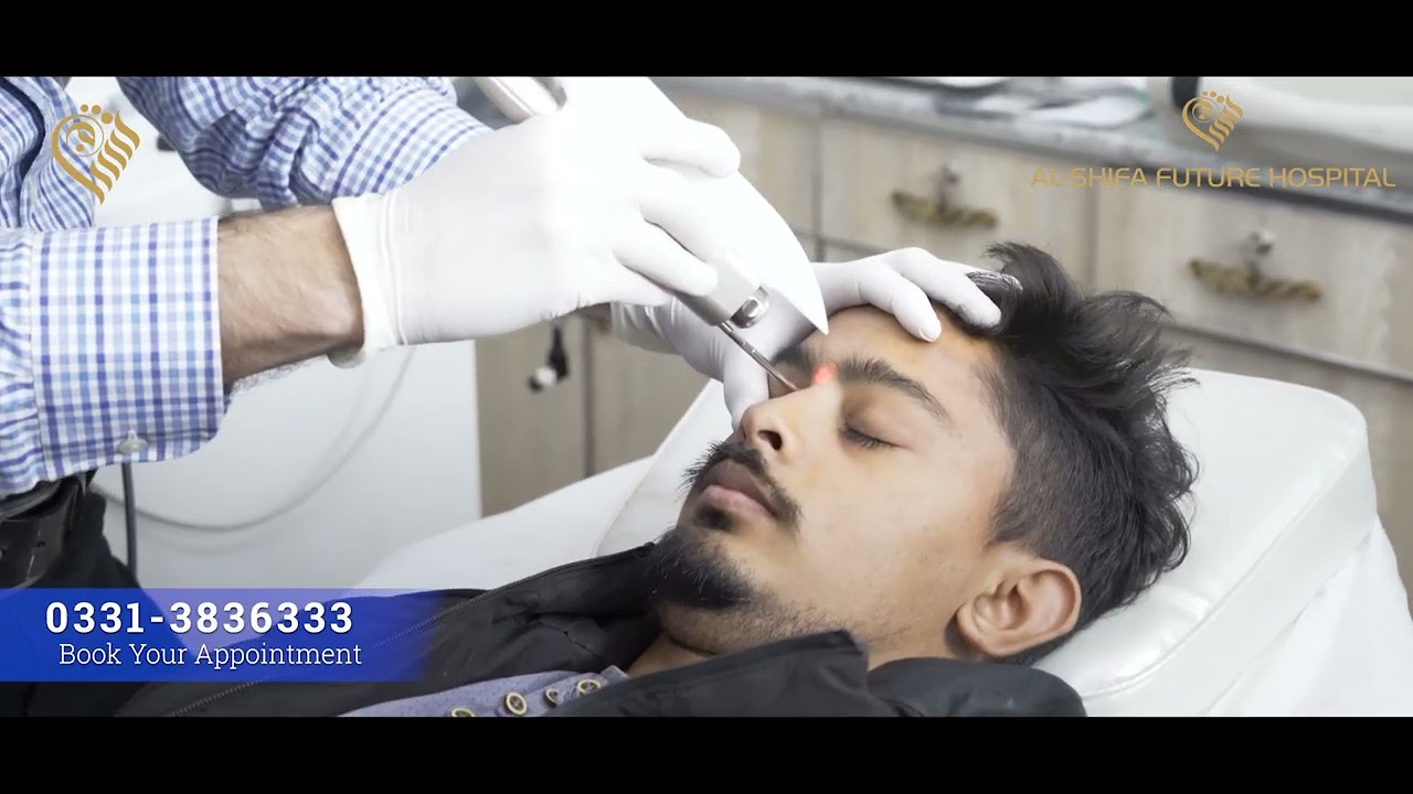 hair-removal-fotona-hair-removal-al-shifa-future-hospital