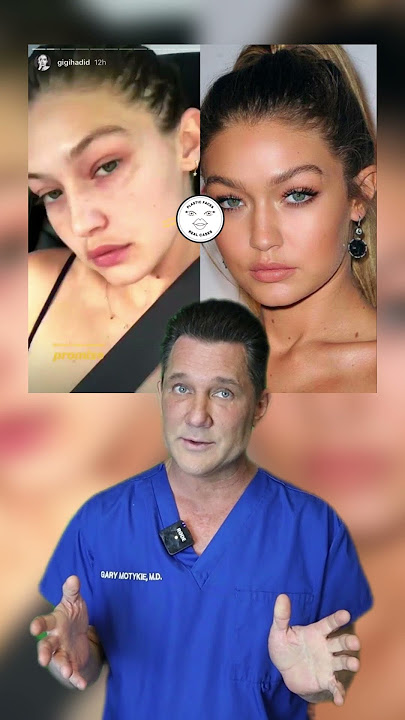 Plastic Surgery Check: Gigi Hadid #shorts