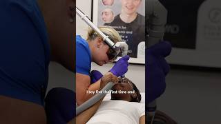Birthmark Removal : Fading After Just One PicoWay Treatment!