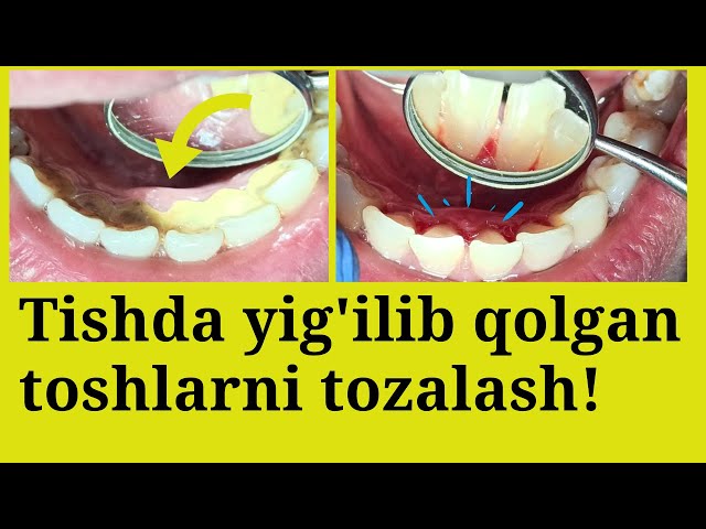 Ikki erkak tomonidan sikilgan yosh xotinning porno videosi