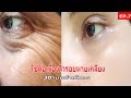 สูตรพอกหน้าลดริ้วรอยให้เห็นผล | Anti-Aging Face Mask, How To Remove WRINKLES.