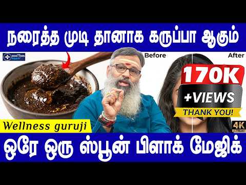 இளநரையை ஓட ஓட விரட்டலாம் | Reverse premature grey hair naturally | Wellness Guruji |Doctors Neram