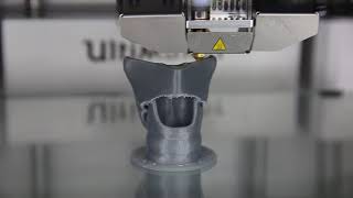 3D Print Larynx Closeup