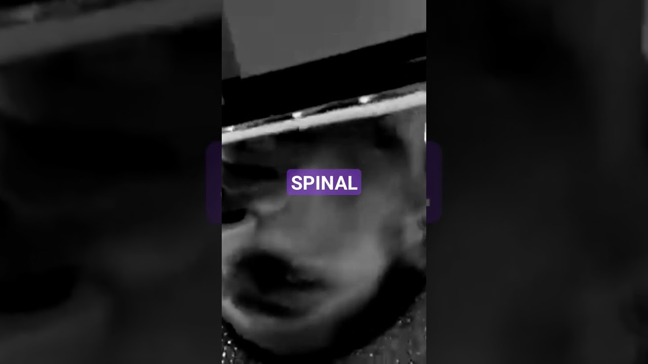 KILLER INSTINCT SPINAL