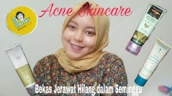 Acne Skincare+Bekas jerawat hilang dalam seminggu - Durasi: 12.45. 