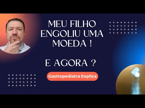 Vídeo: Se A Criança Engoliu Algo: Primeiros Socorros