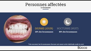 Le bruxisme (grincement et serrement des dents)