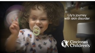 How Hollywood-like masks and 3D models aid surgeons | Cincinnati Children's
