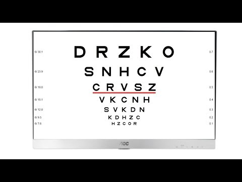 Vision Charting System