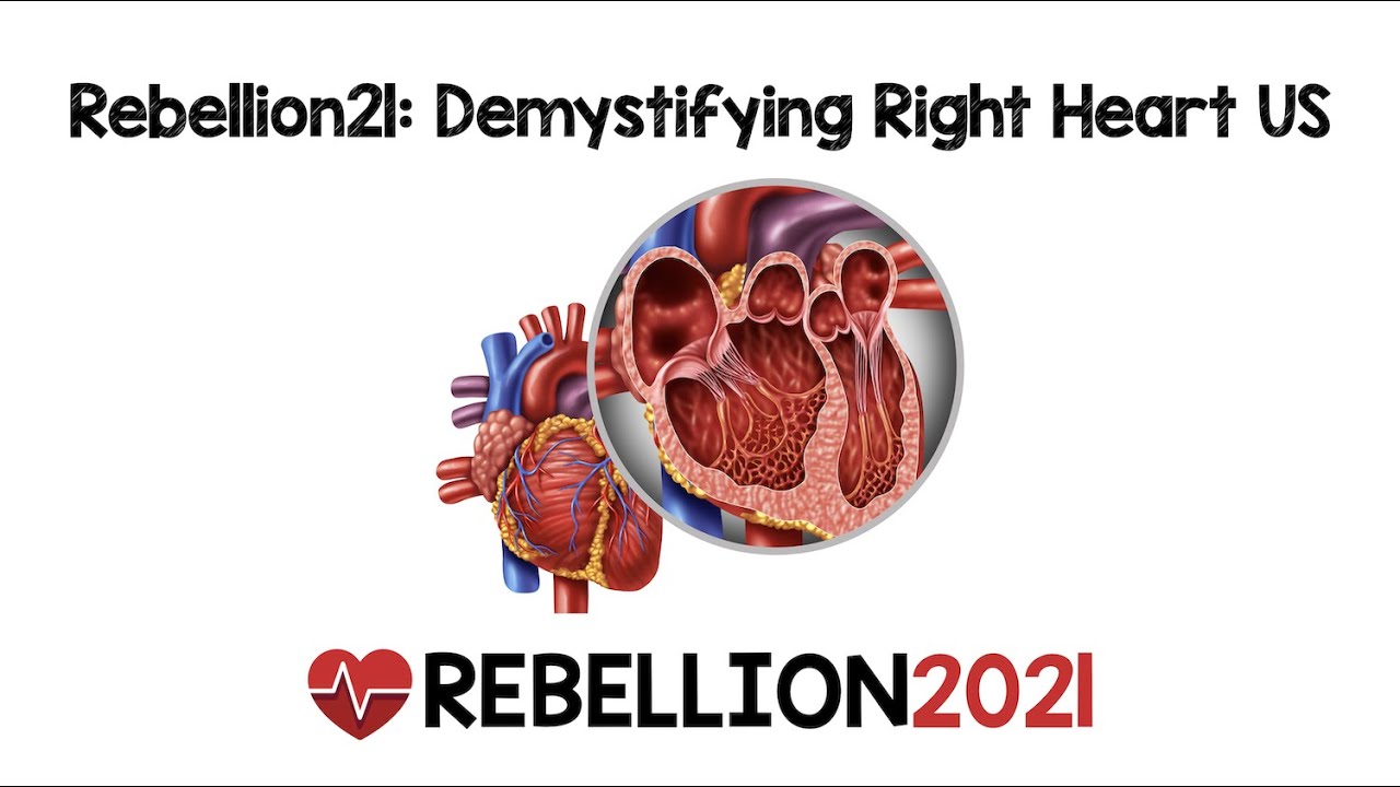 Rebellion21: Demystifying Right Heart Ultrasound via Melissa Myers, MD