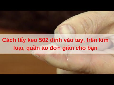 Video Cách tẩy keo 502 dính vào tay, trên kim loại, quần áo... - youtube