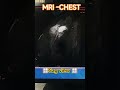 MRI _chest right sided breast lesson 🩻🩻 #radiology  #medicalimaging #youtubeshorts